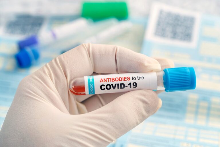 Spanish researchers open up Covid antibody tests tech