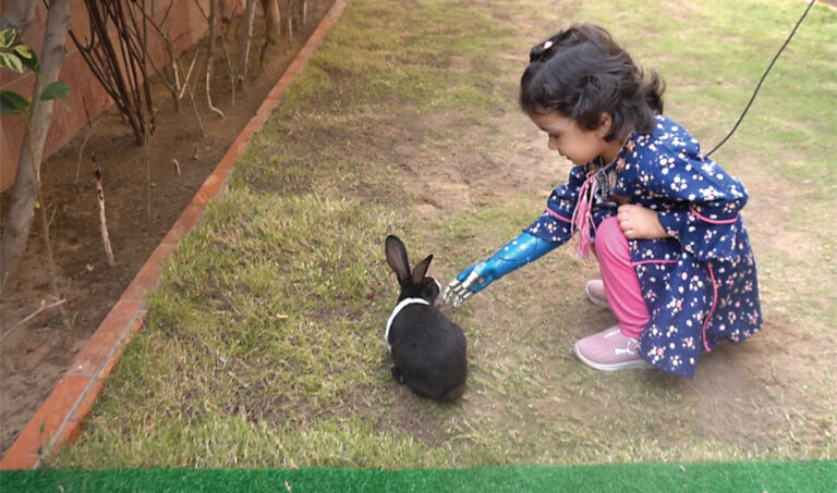 Inspired by Disney princess Elsa, Pakistani girl gets ‘magical’ blue prosthetic arm