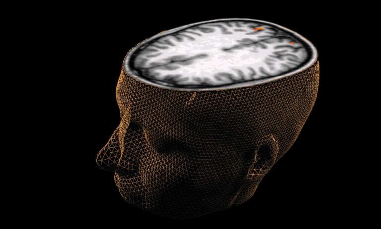 Even mild COVID-19 can reduce brain size: Study