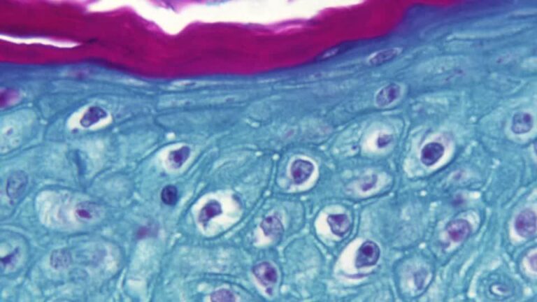 Switzerland reports first monkeypox case