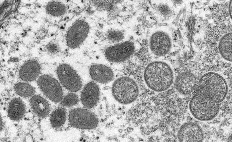 Spain, Brazil report first monkeypox-related deaths outside Africa