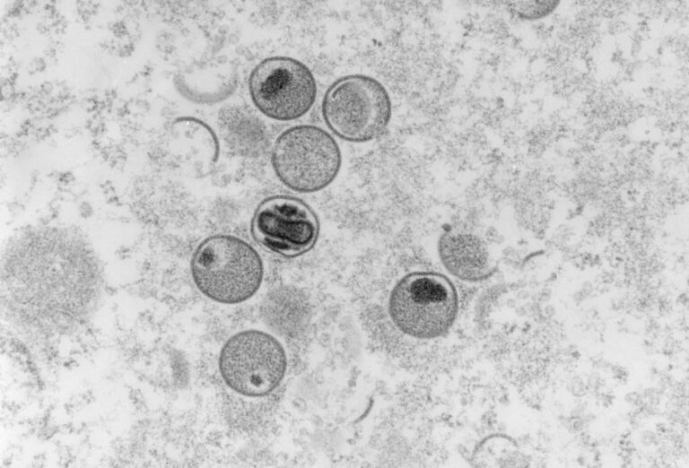 Sudan detects first case of monkeypox in Darfur