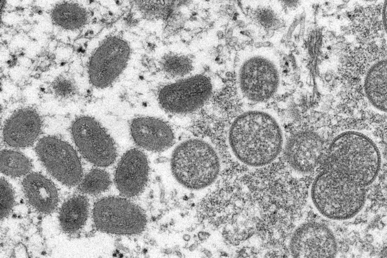 Egypt detects first monkeypox case